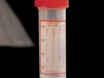 Контейнери з борною кислотою (25 х 90 мм) 30 мл