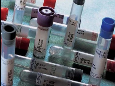 Для гематологічних досліджень