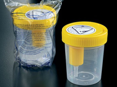 Контейнери та пробірки з вакуумною системою